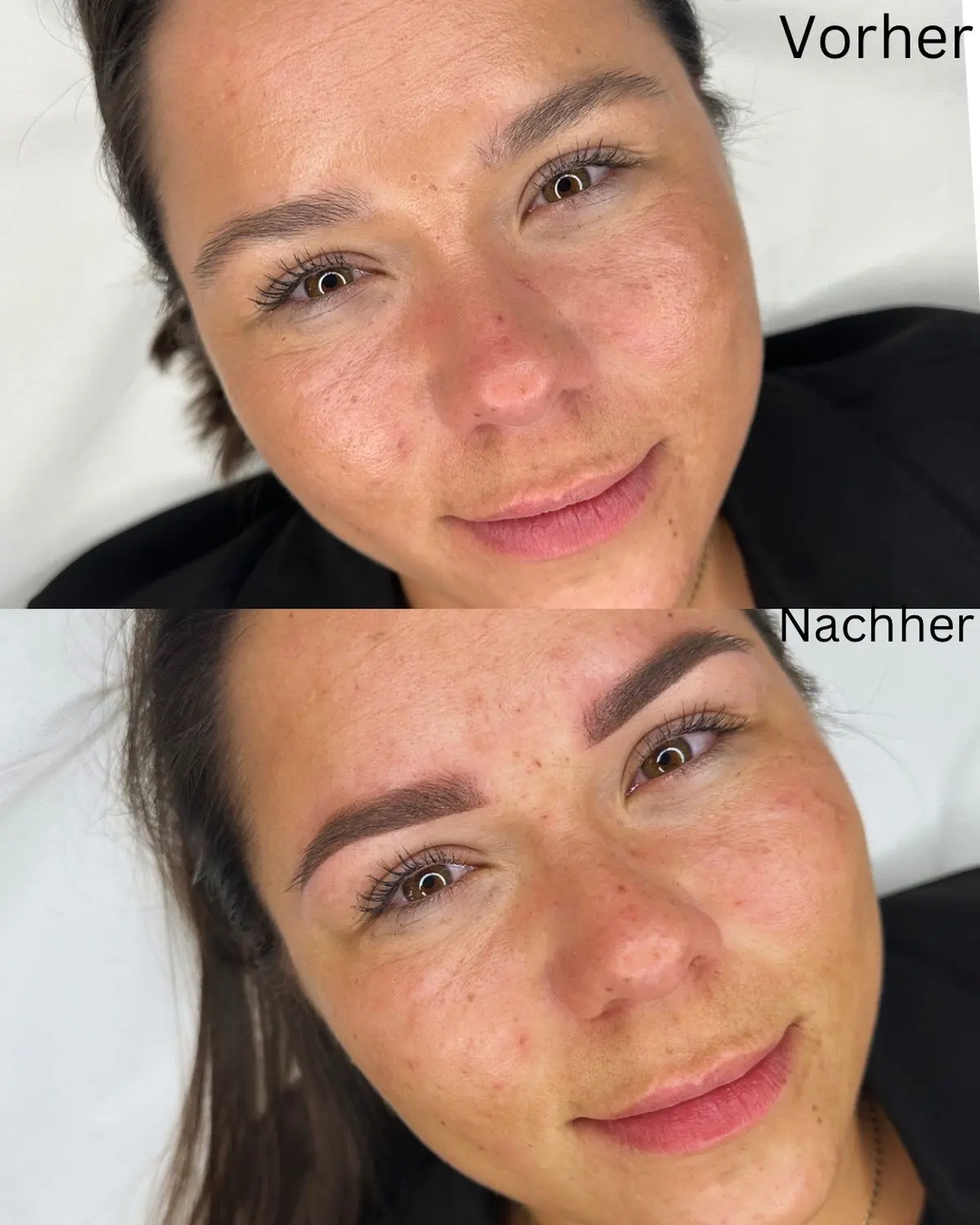 Vorher Nachher Bild Mädchengesicht von Frankipmo