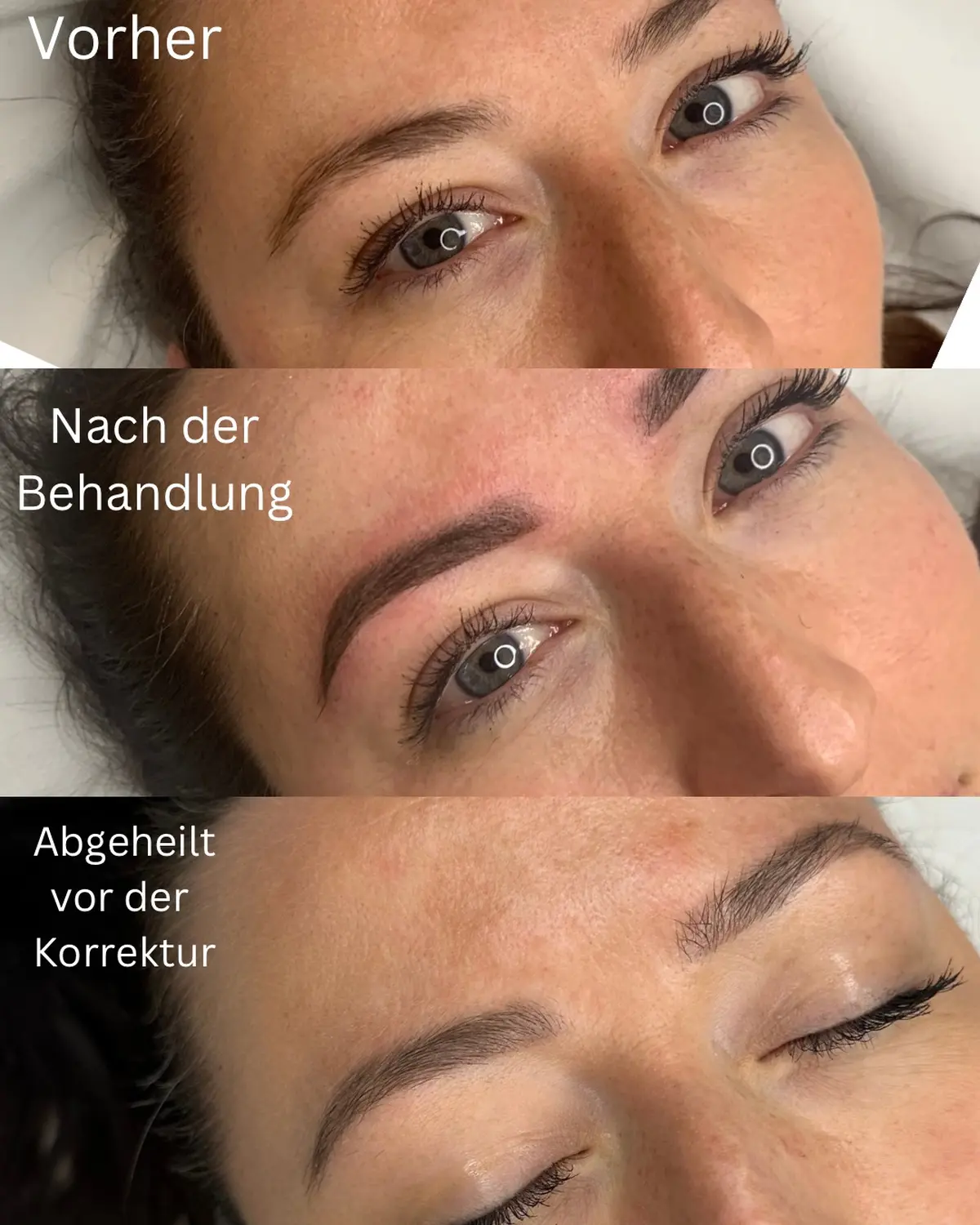Vorher Nachher Bild Mädchengesicht von Frankipmo